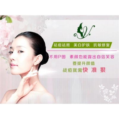 亦菲祛斑祛痘项目加盟介绍图3