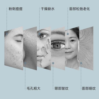 新品眼部射频RF导入按摩美眼仪淡化细纹EMS微电超声刀提拉紧致仪图3