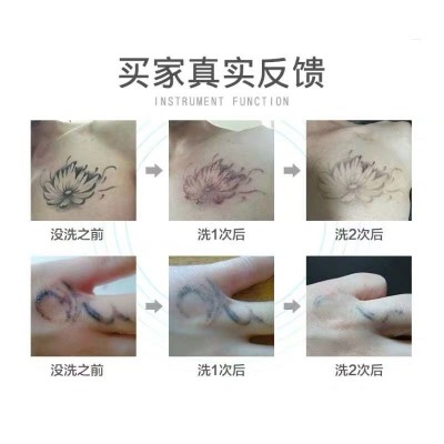 手持皮秒笔 激光洗眉笔 洗纹身扫斑 红蓝光皮秒美容仪 跨境优品图4