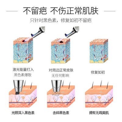 手持皮秒笔 激光洗眉笔 洗纹身扫斑 红蓝光皮秒美容仪 跨境优品图5
