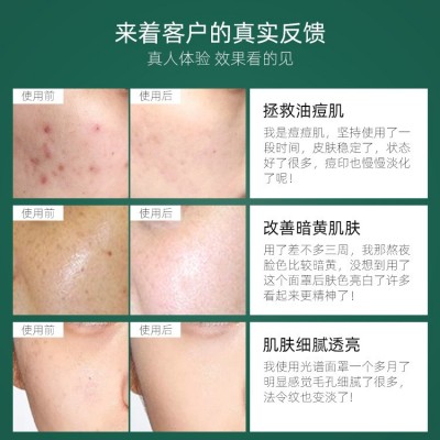 光谱仪美容仪红蓝光美容仪大排灯面罩祛痘仪器美容院专用光子嫩肤图4