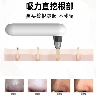 电动可视黑头仪家用毛孔清洁器洁面仪导出小气泡美容仪器吸黑头仪图3