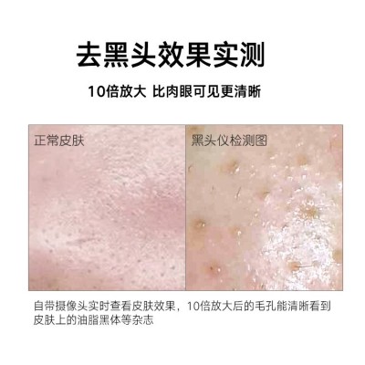 高清wifi电动黑头仪粉刺吸黑头仪面部粉刺毛孔清洁器可视化黑头仪图4