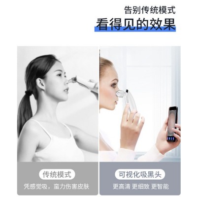 高清wifi电动黑头仪粉刺吸黑头仪面部粉刺毛孔清洁器可视化黑头仪图2