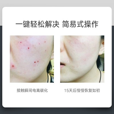去斑扫斑德国小白点痣笔激光取祛斑专用美容仪器神点痔去 痣点斑笔图4