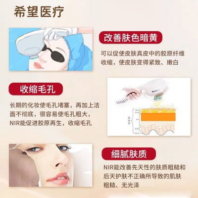 牛奶光美容仪手持光子嫩肤DPL脸部提亮淡痘印淡化斑图4