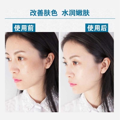 导入仪器外体可塑泌水光颜微晶八代补水美容院水光枪MTS良美耗材图4