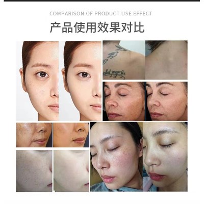 台式小皮秒黑科技无创洗眉机袪斑仪洗纹身袪黑色素小型美容院专用图4