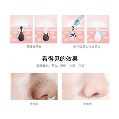 漫盈电动黑头仪吸黑头仪毛孔清洁器黑头清洁仪吸黑头的美容仪器图4