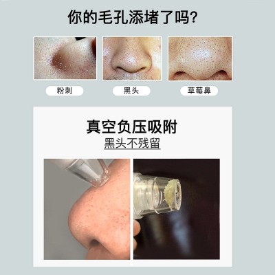 亚马逊跨境可视化黑头仪电动吸黑头毛孔清洁器热敷去黑头清洁面仪图3