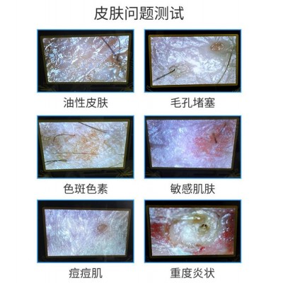 小气泡美容仪器美容院专用脸部清洁导入去黑头皮肤检测管理水氧仪图3