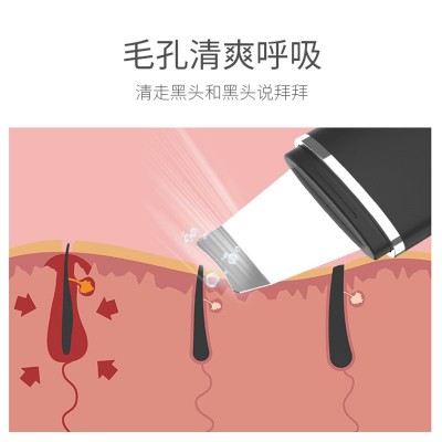 超声波铲皮机去黑头家用美容离子导入导出超声刀洁面仪毛孔清洁器图2