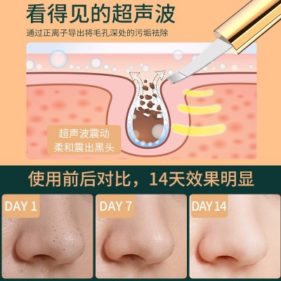 新款家用超声波铲皮机 毛孔清洁吸黑头仪器洁面仪 导入导出美容仪图3