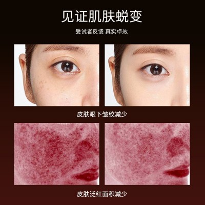 LED七色彩光面膜仪硅胶充电款面罩美容仪美白嫩肤导入脸部光疗谱图5