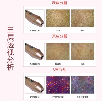 魔奇镜皮肤测试仪脸部智能肌肤水分检测分析仪美容院面部检查仪器图2
