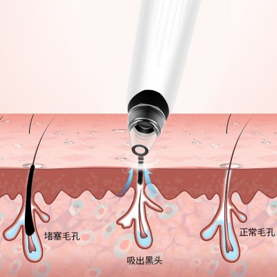 亚马逊跨境吸黑头仪日常家用鼻子毛孔清洁仪电动美容仪器抖音同款图4