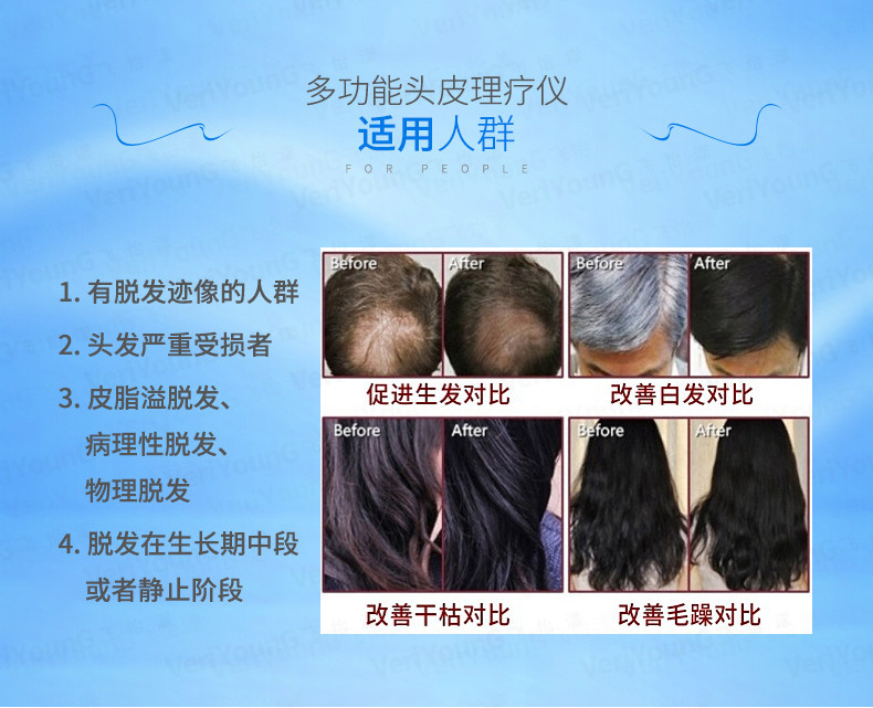 激光生发仪_01.jpg