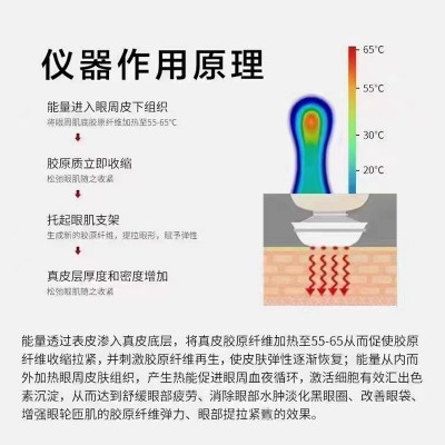 眼部修护大师脸部射频美容仪改善衰老淡化眼纹黑眼圈图2
