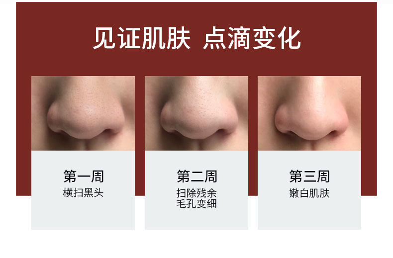 黑头仪详情_09.jpg