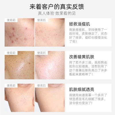 跨境 LED光谱仪七彩光子嫩肤仪 PDT折叠大排灯 嫩肤光疗美容仪器图2