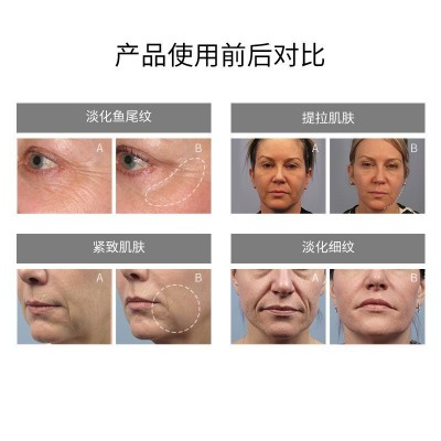 新款半圆RF射频仪离子多功能光子嫩肤导入导出家用脸部射频美容仪图2