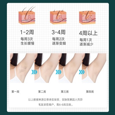 家用激光脱毛仪器不永久剃毛器ipl光子蓝宝石强脉冲冰点脱毛仪图2