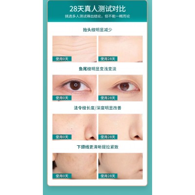宙斯类EMS按摩导入美容仪器 脸部家用抗衰紧致光子嫩肤rf射频导入图3