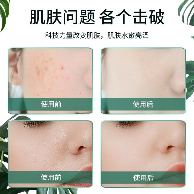 注氧仪便携式补水手持纳米喷雾气泡补水仪高压雾化家用面部美容仪图4