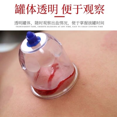 泻血真空拔罐器家用套装拔血罐采血刺血放血心天排瘀刺络大号气罐图3